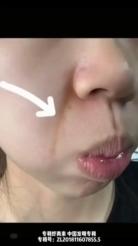 我不允许还有人没抢到这款五个女博士的虾青素，一粒高达12mg虾青素，一粒顶三粒，效果更好！