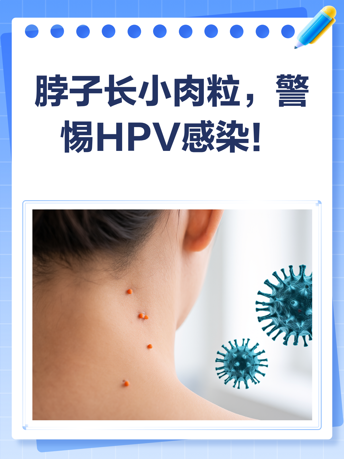 脖子上的小肉粒，竟是HPV感染信号？