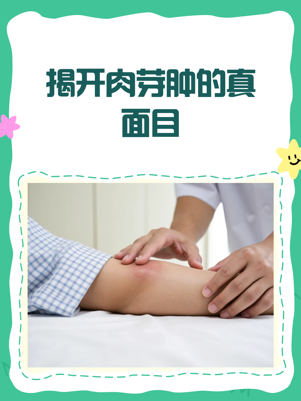 肉芽肿？听起来吓人，其实没那么复杂！