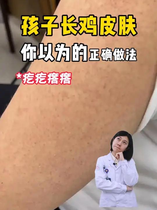 孩子胳膊腿上疙疙瘩瘩影响美观,可能是鸡皮肤!教家长一招处理育儿经验分享毛周角化
