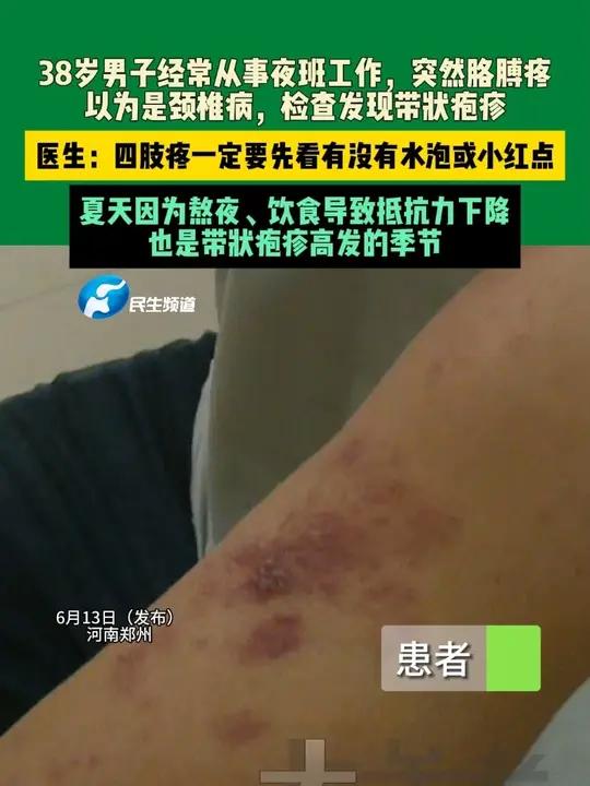 6月13日(发布)河南郑州,38岁男子经常从事夜班工作,突然胳膊疼,以为是颈椎病,检查发现