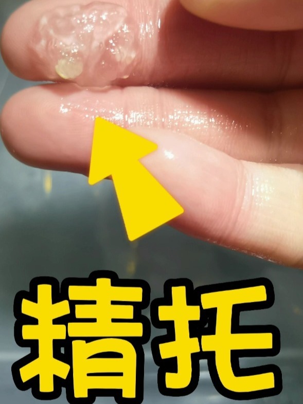 六六精托是这样的,到了六角恐龙繁殖季节