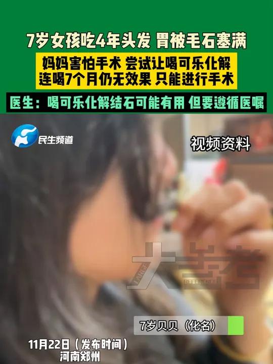 11月22日河南郑州,7岁女孩吃4年头发,胃被毛石塞满。妈妈害怕手术 尝试让喝可乐化解,连