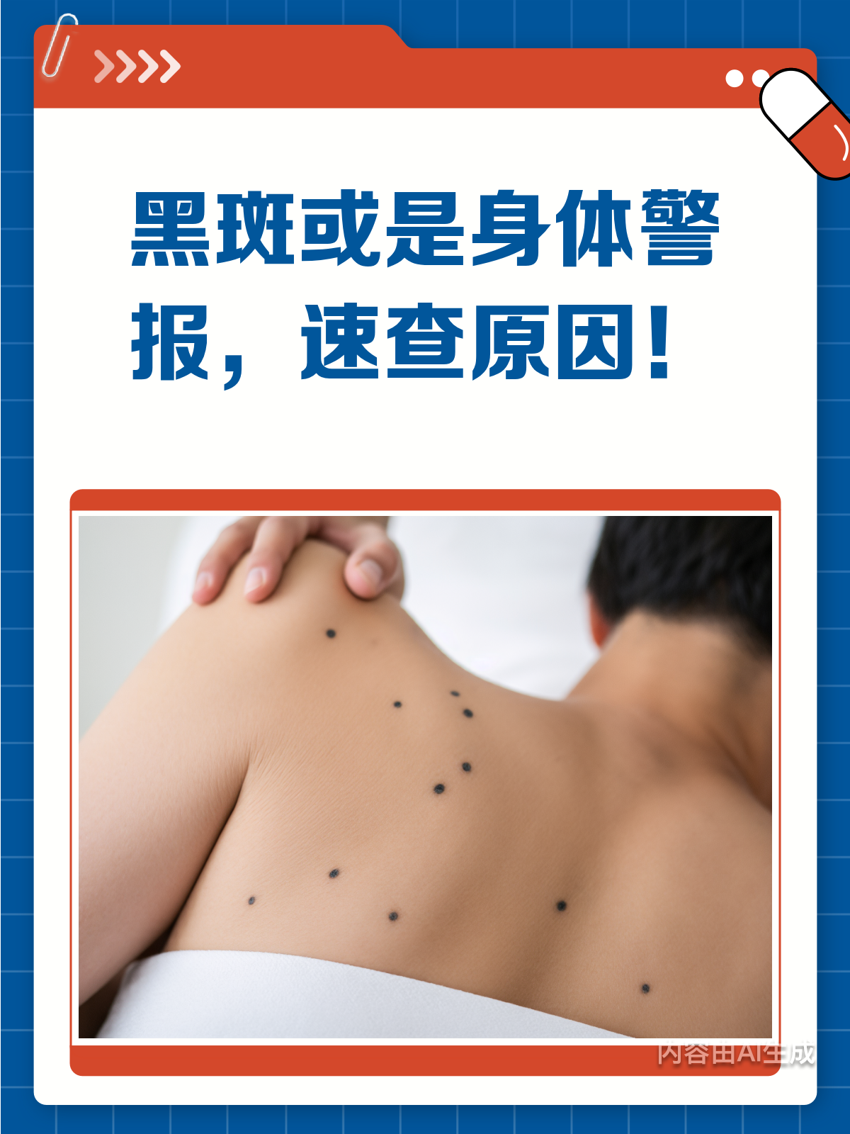 黑斑竟是身体警报?医生揭秘其背后真相!