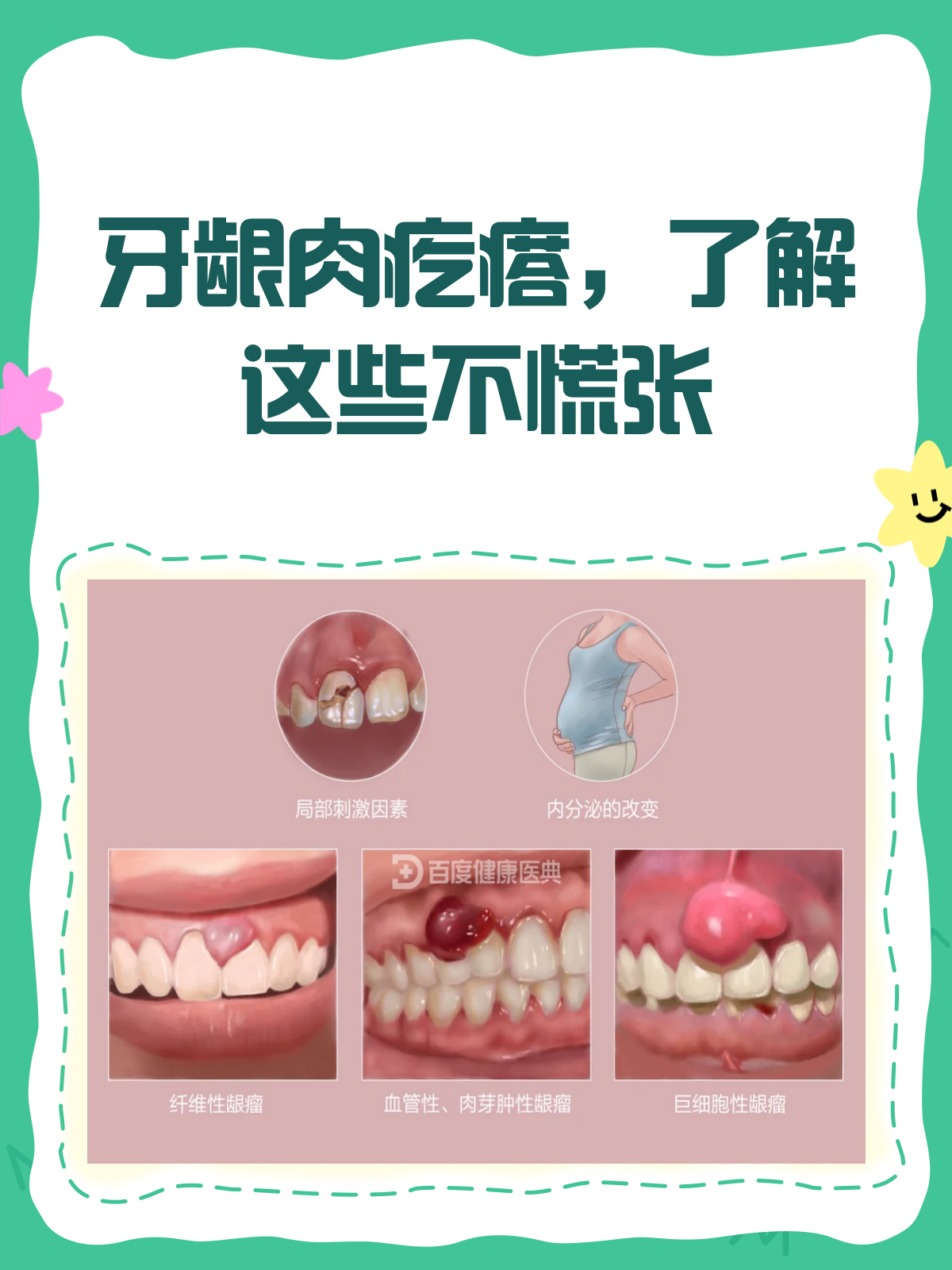 牙龈长肉疙瘩？别急，先看这篇科普！