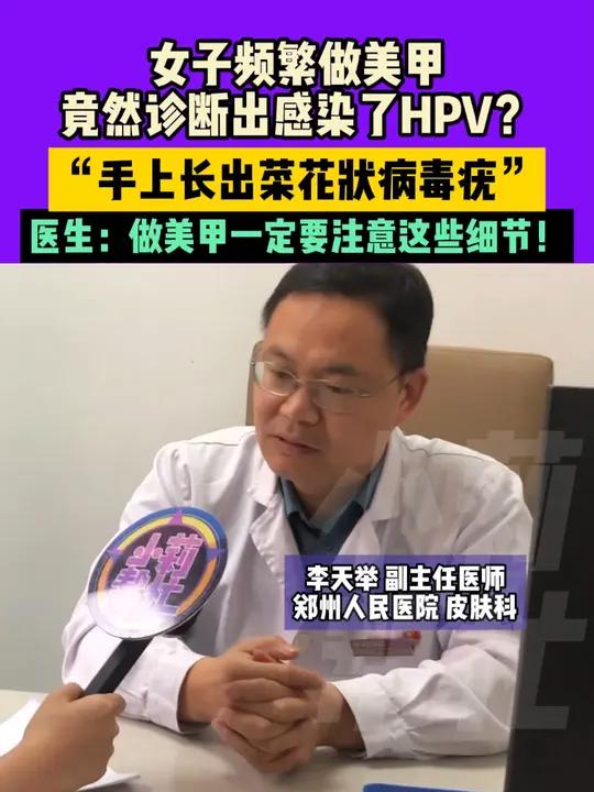 女子频繁做美甲竟然诊断出感染了HPV?“手上长出菜花状病毒疣”医生:做美甲一定要注意这些细