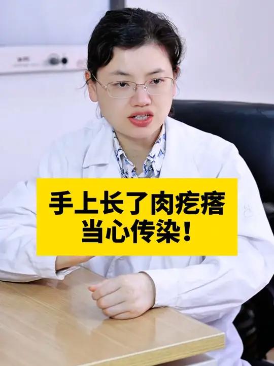 手上长瘊子,剪掉根本没用,医生教你处理!#HPV #寻常疣 #瘊子 #科普 #抖出健康知识