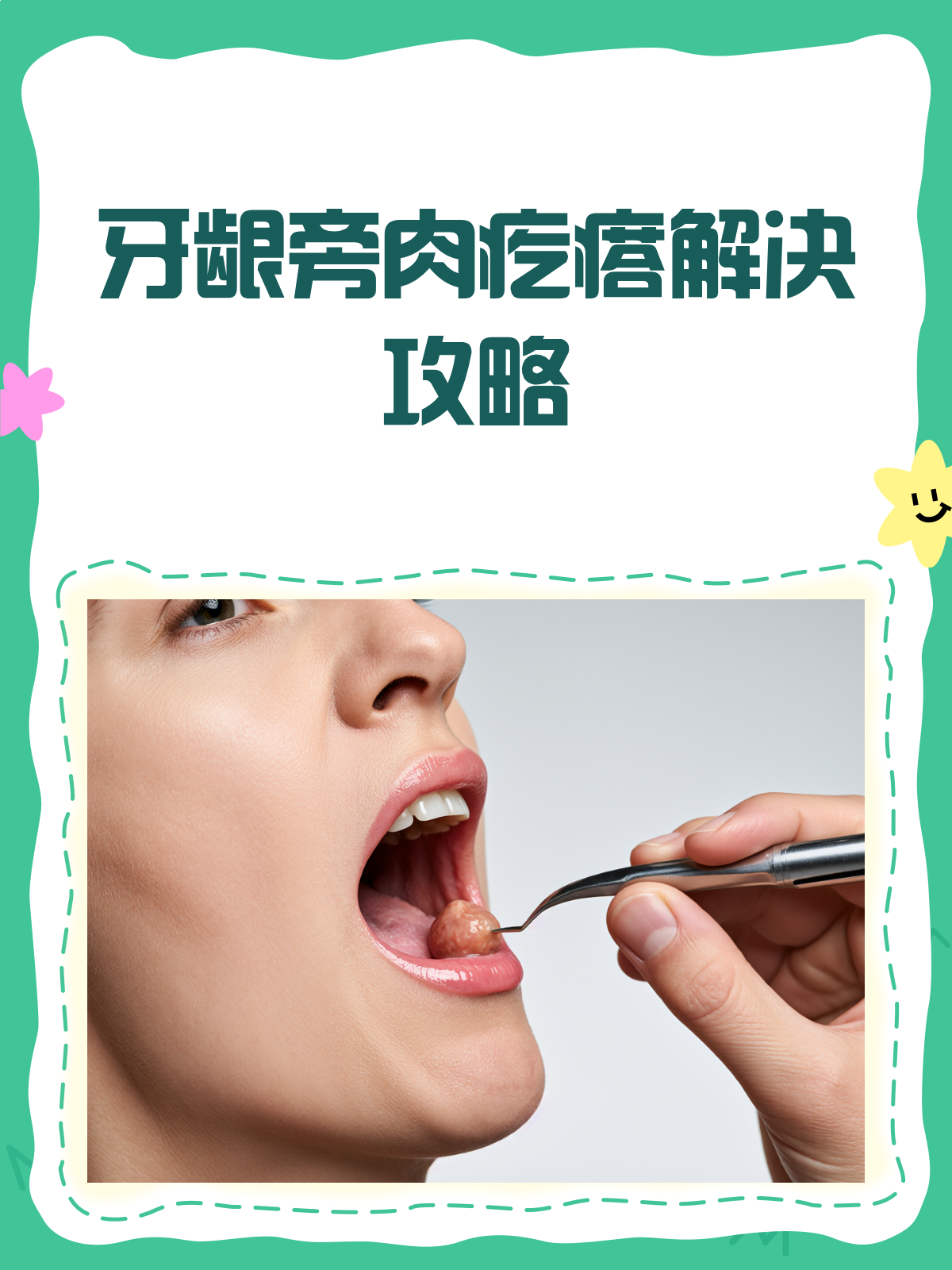 牙龈旁长肉疙瘩？别急，这样处理就对了！