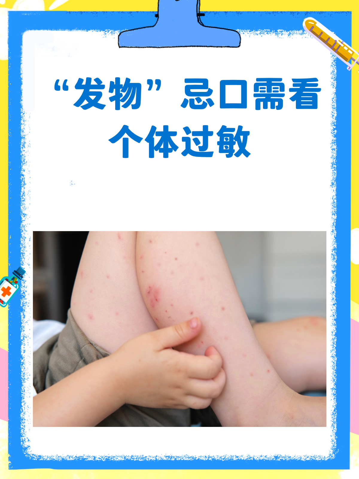 “发物”忌口看这里!个体过敏才是关键