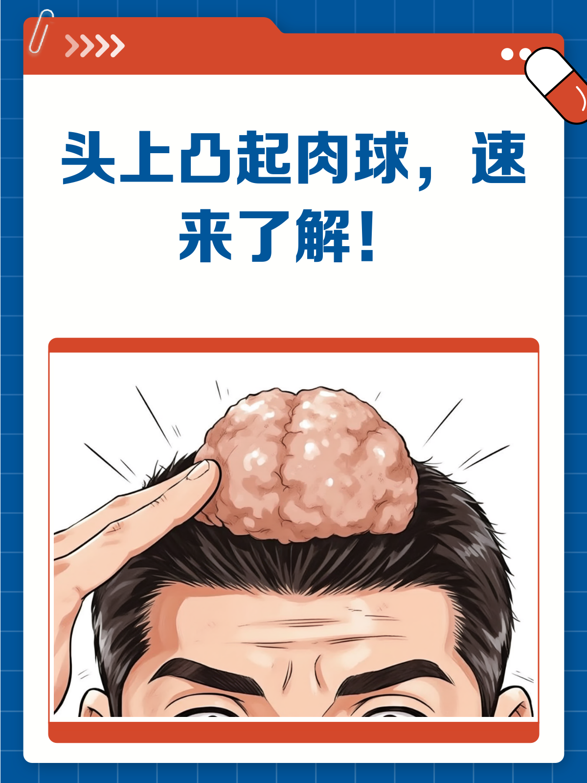 头上长肉球？别急，先搞清这几点！