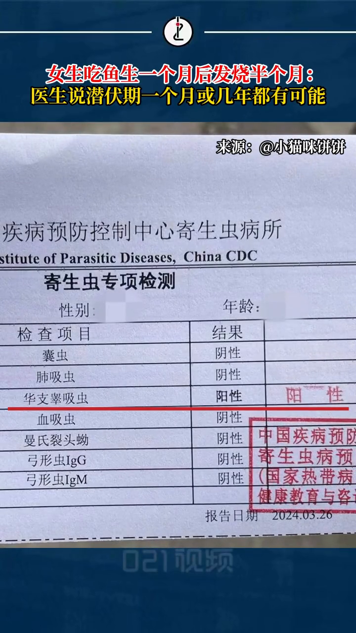 女子吃顺德鱼生一个月后检出寄生虫