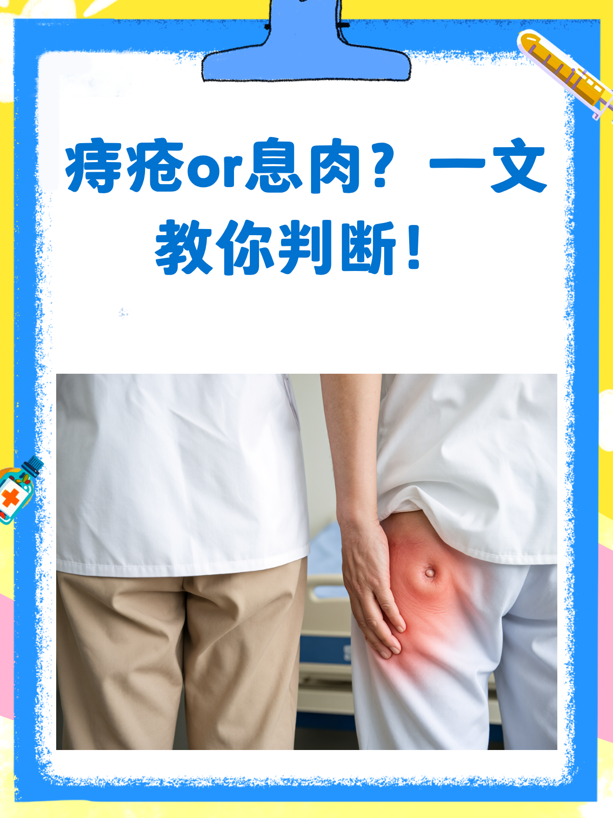 痔疮or息肉？教你几招轻松辨别！