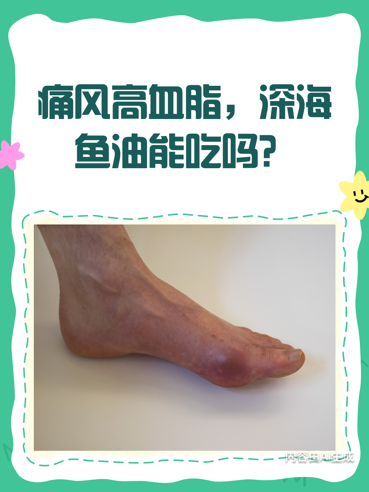 痛风又高血脂?深海鱼油能不能吃?看这里!