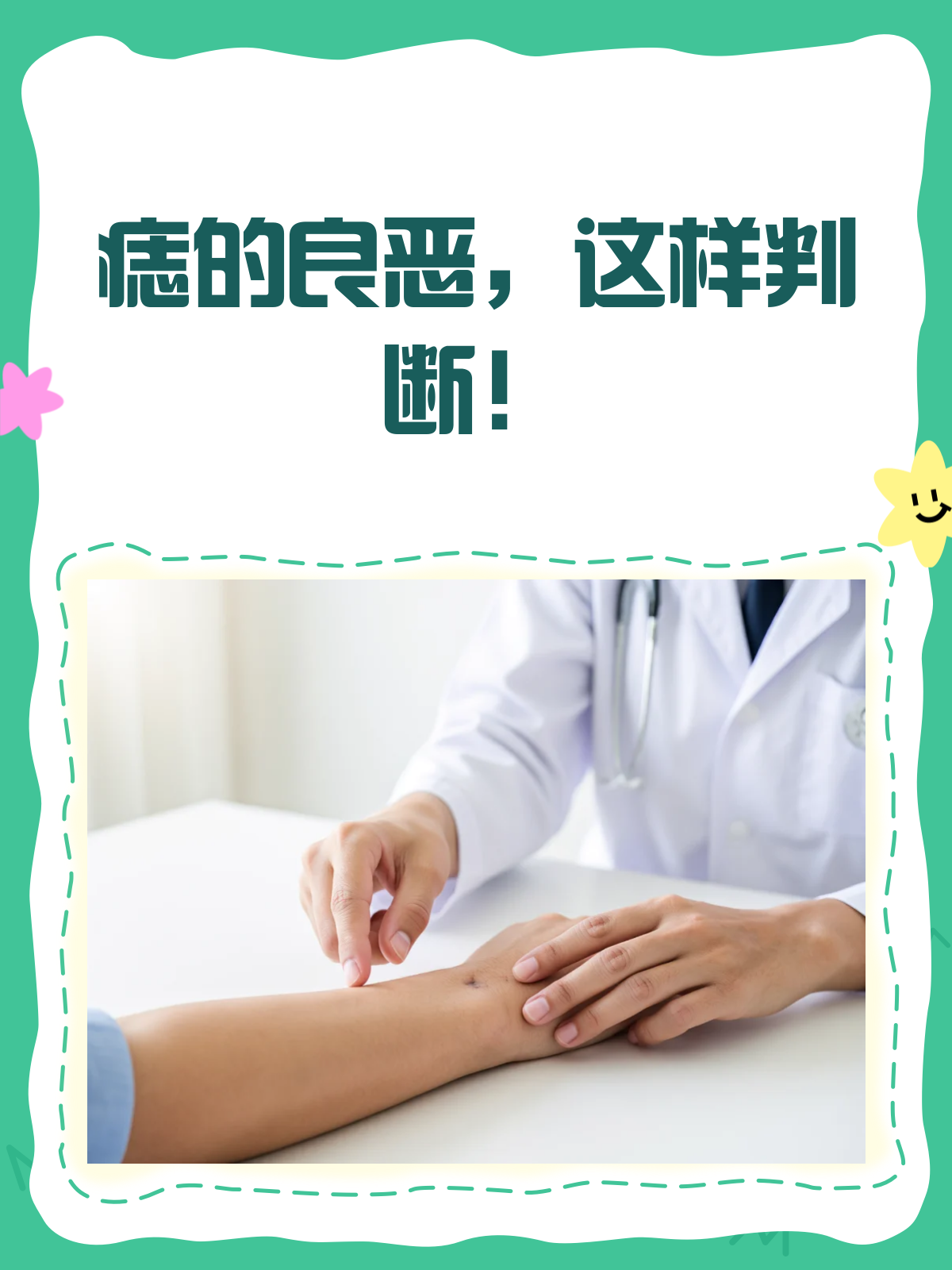 痣的良恶判断秘籍！自我检查不求人