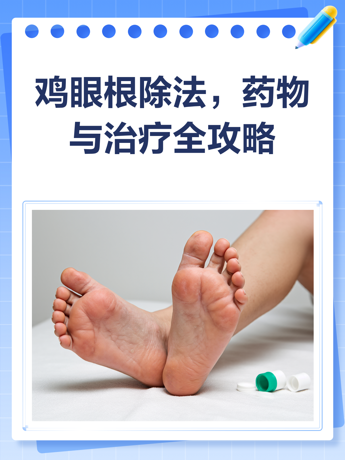 鸡眼烦恼？来看这篇根治攻略