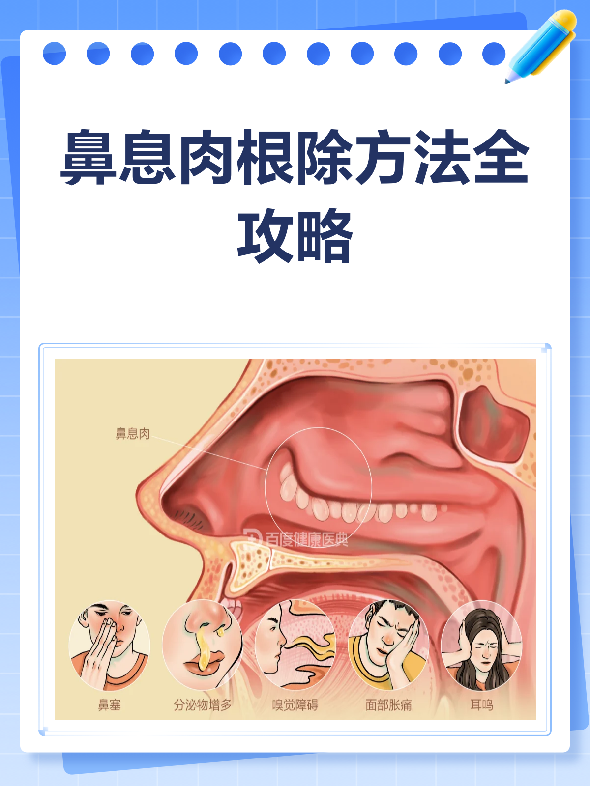 鼻息肉治疗全攻略,怎样才能根除它?