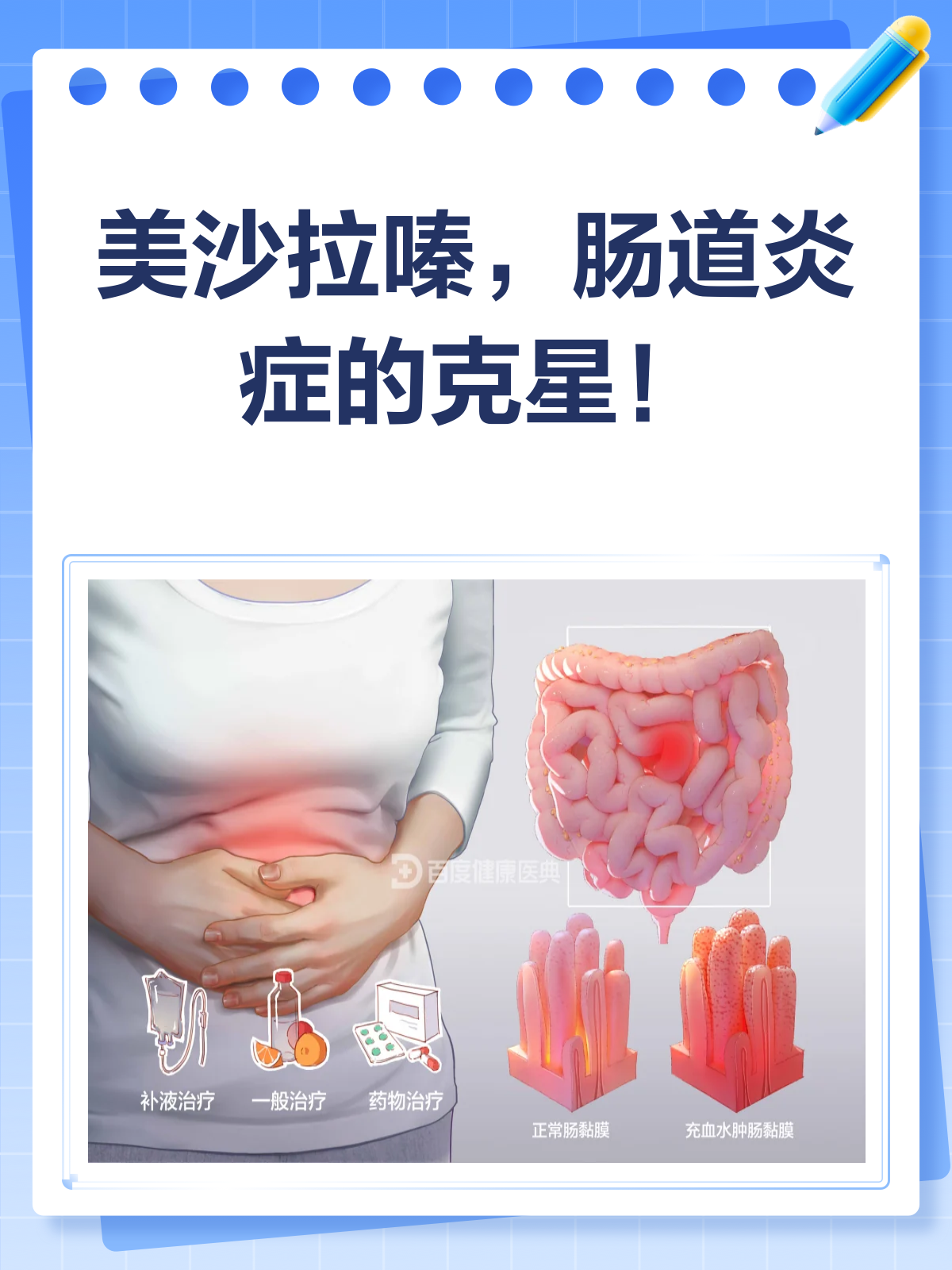 美沙拉嗪,肠道炎症的“灭火器”