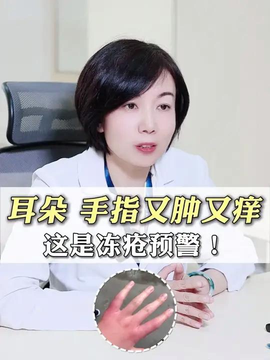 一到冬天就长冻疮,又疼又痒,怎么办!今天张教授30秒教你:快速判断冻疮的方法,以及如何低成