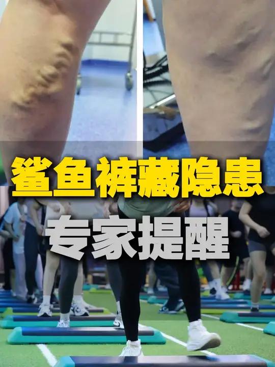 网红鲨鱼裤爆火 专家:小心这件时尚单品!