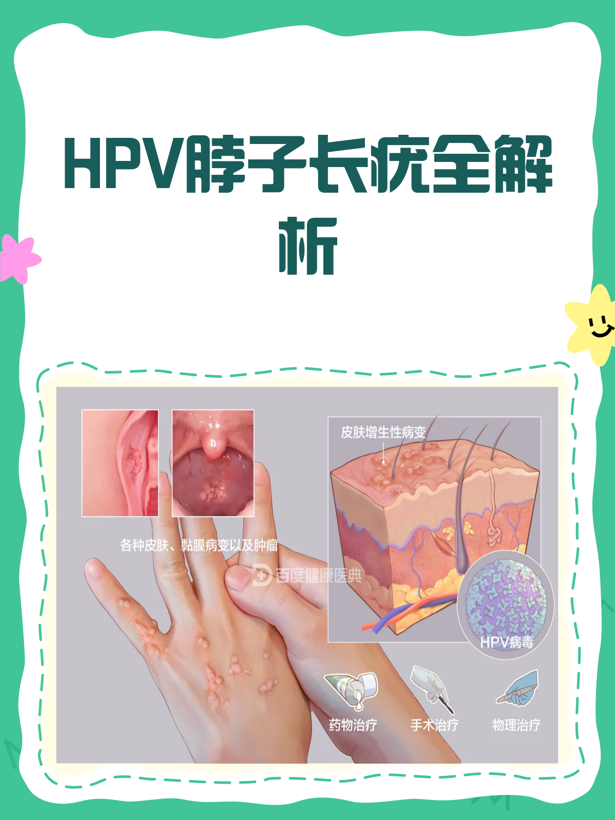 脖子上的“小肉球”,竟是HPV作祟?