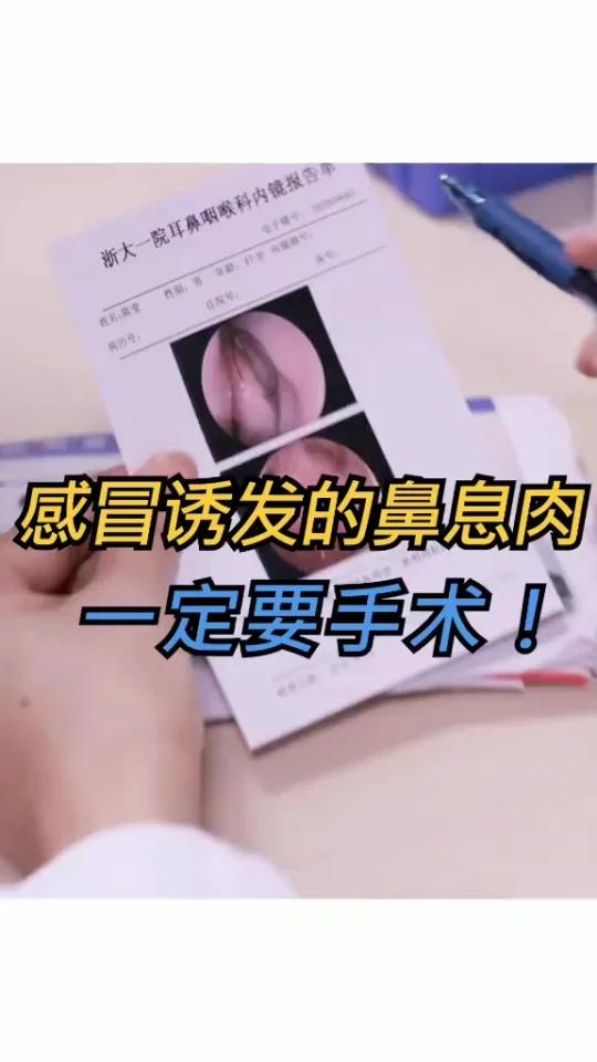 感冒诱发鼻息肉,一定要手术!