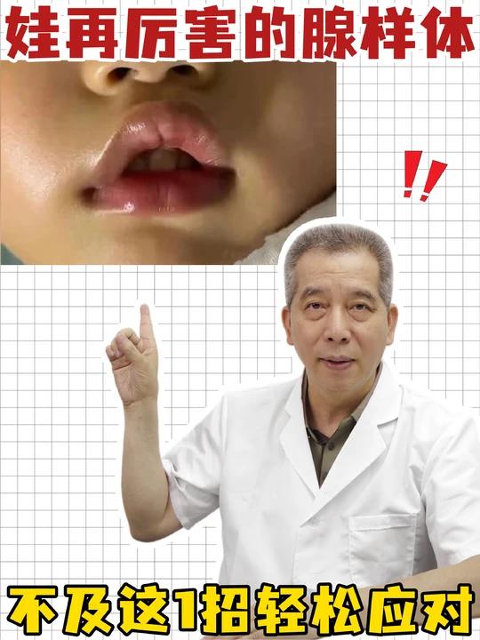 娃再厉害的腺样体，也不及这1招轻松应对