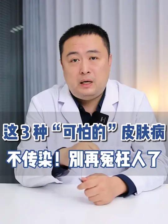 这 3 种皮肤病看着吓人,其实都不传染,看完别再误会了