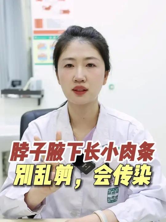 脖子腋下长这种小肉揪，千万别乱剪！小心越剪越多！