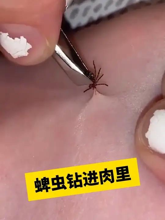 夏天看到这种小虫子,千万不要用手拍!