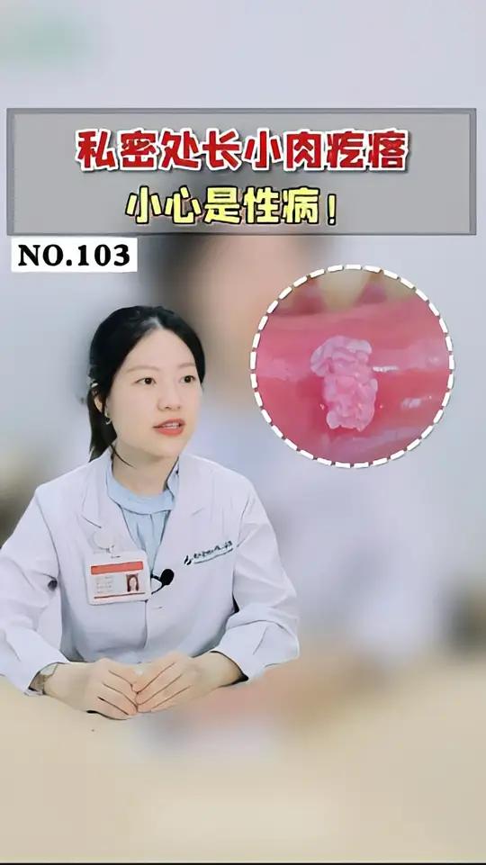 私处长菜花?可能是得了这种X病,不用害怕,通过正规治疗是可以治好的