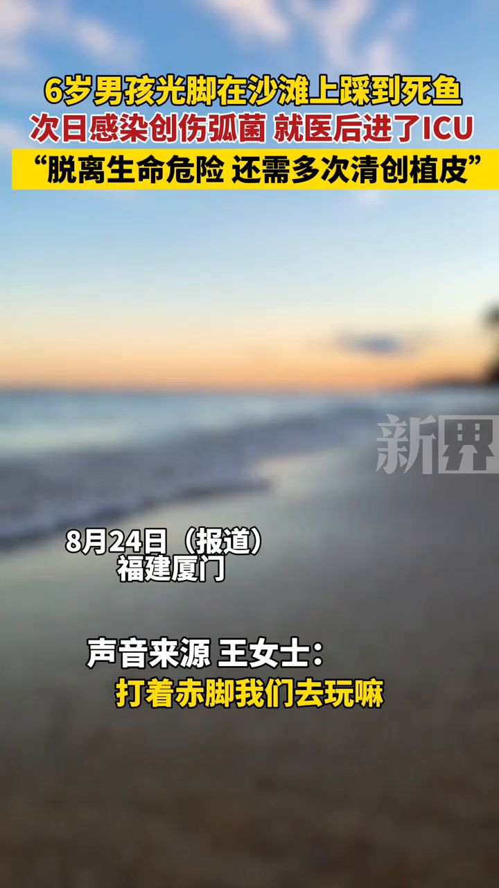 6岁男孩光脚在沙滩上踩到死鱼，次日感染创伤弧菌后进了ICU