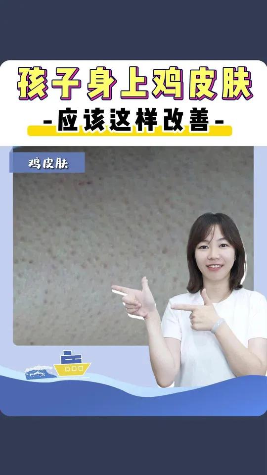 孩子青春期长鸡皮肤,家长要注意这点