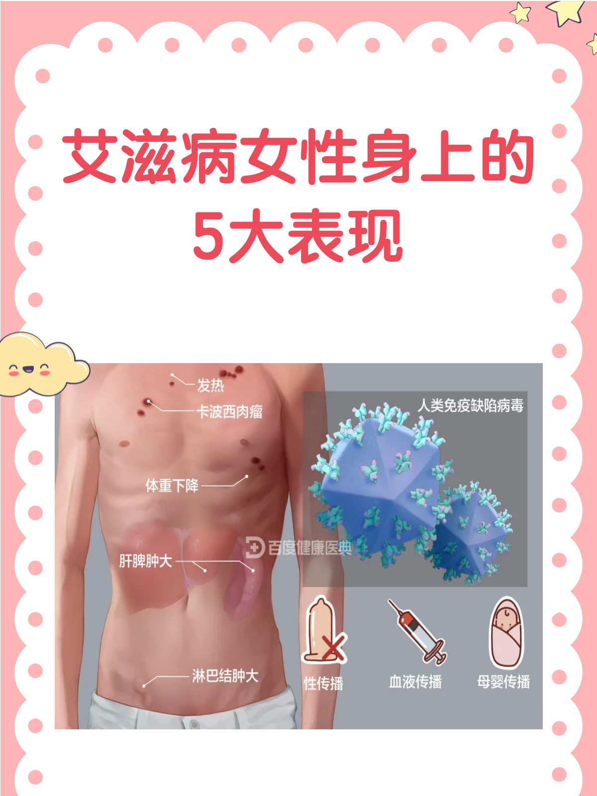艾滋病女性身上的5大表现,你知道吗?