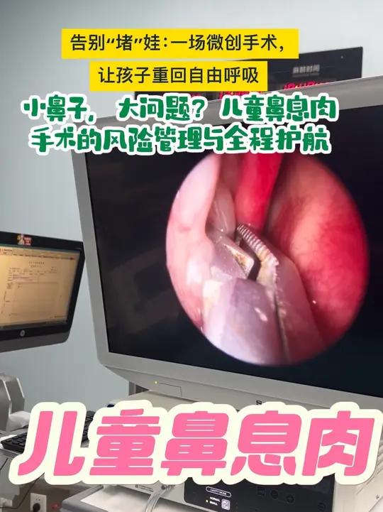 小鼻子，大问题？儿童鼻息肉手术的风险管理与全程护航，告别“堵”娃：一场微创手术，让孩子重回