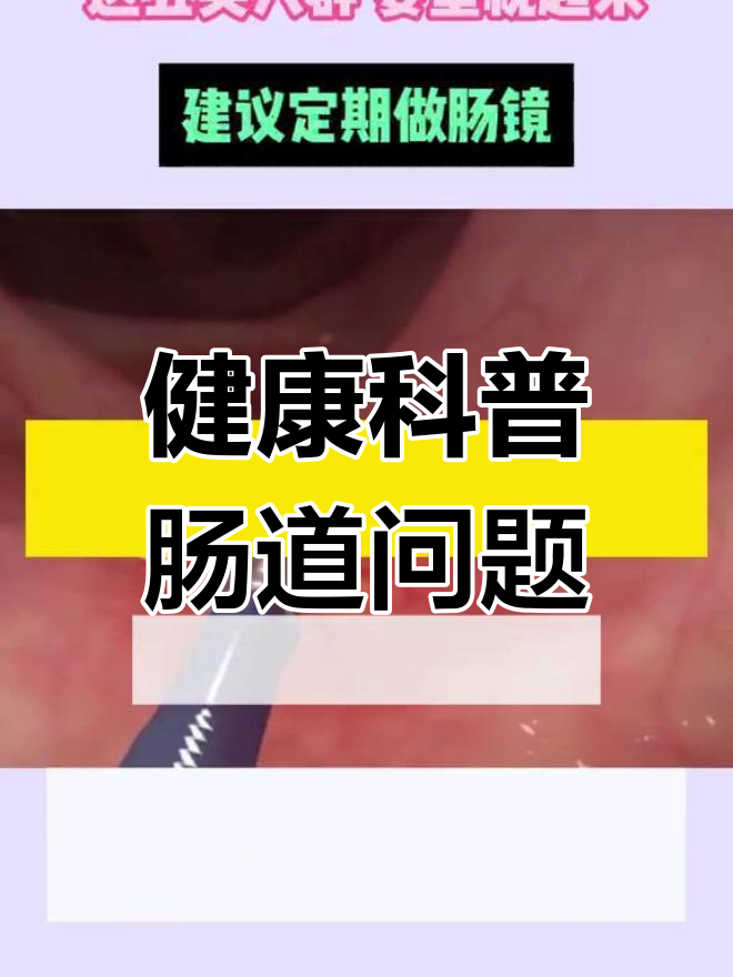 肠癌与息肉的早期信号