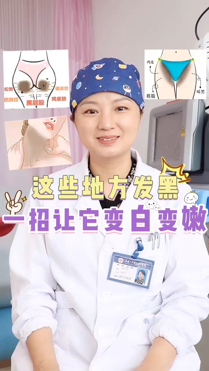身体上有黑斑 这样做轻松解决