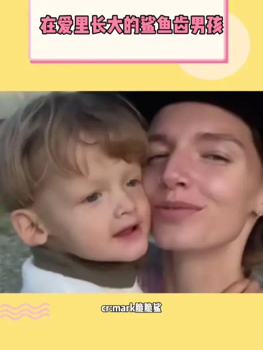 拿到了不好的剧本,却遇到了最好的导演 母爱 温暖 鲨鱼齿男孩