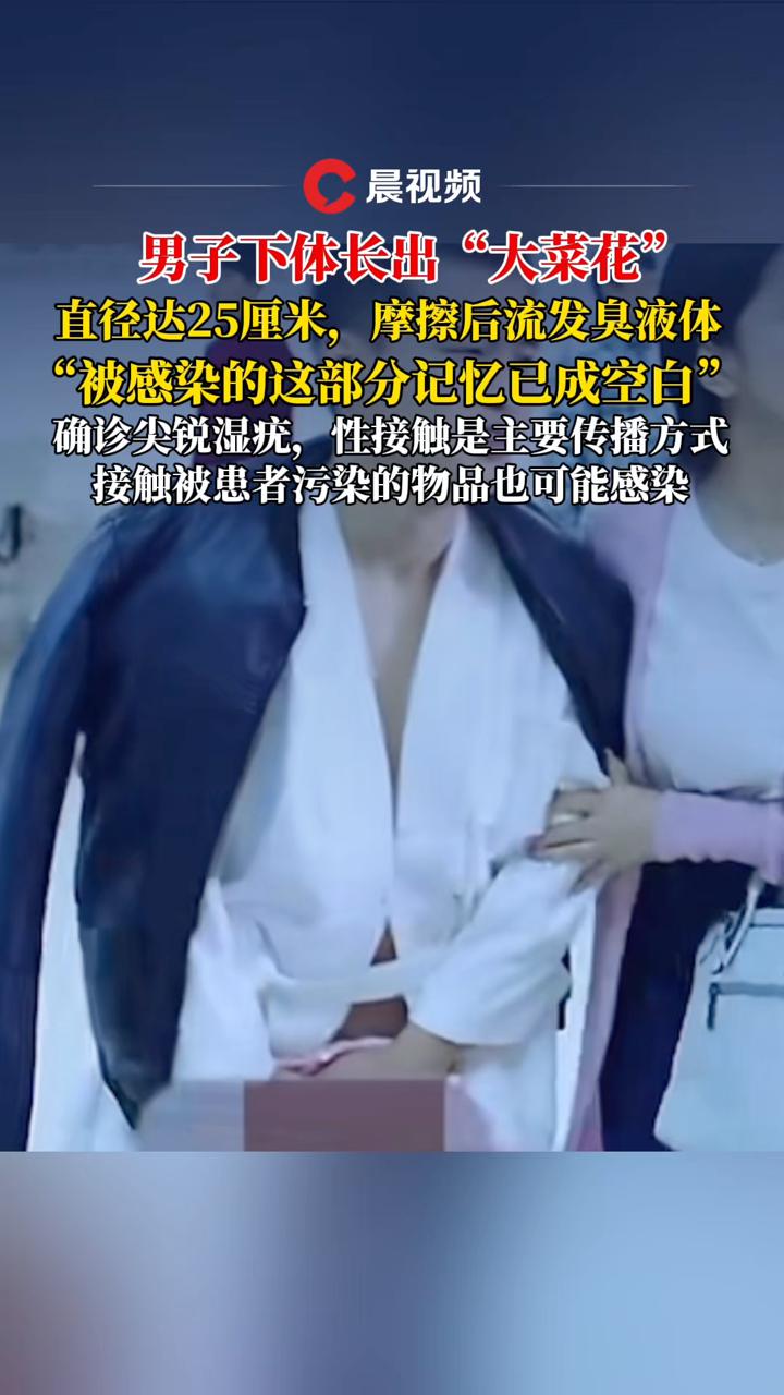 不敢出家门!男子下体长出直径25厘米大的“菜花”,已想不起如何被感染……
