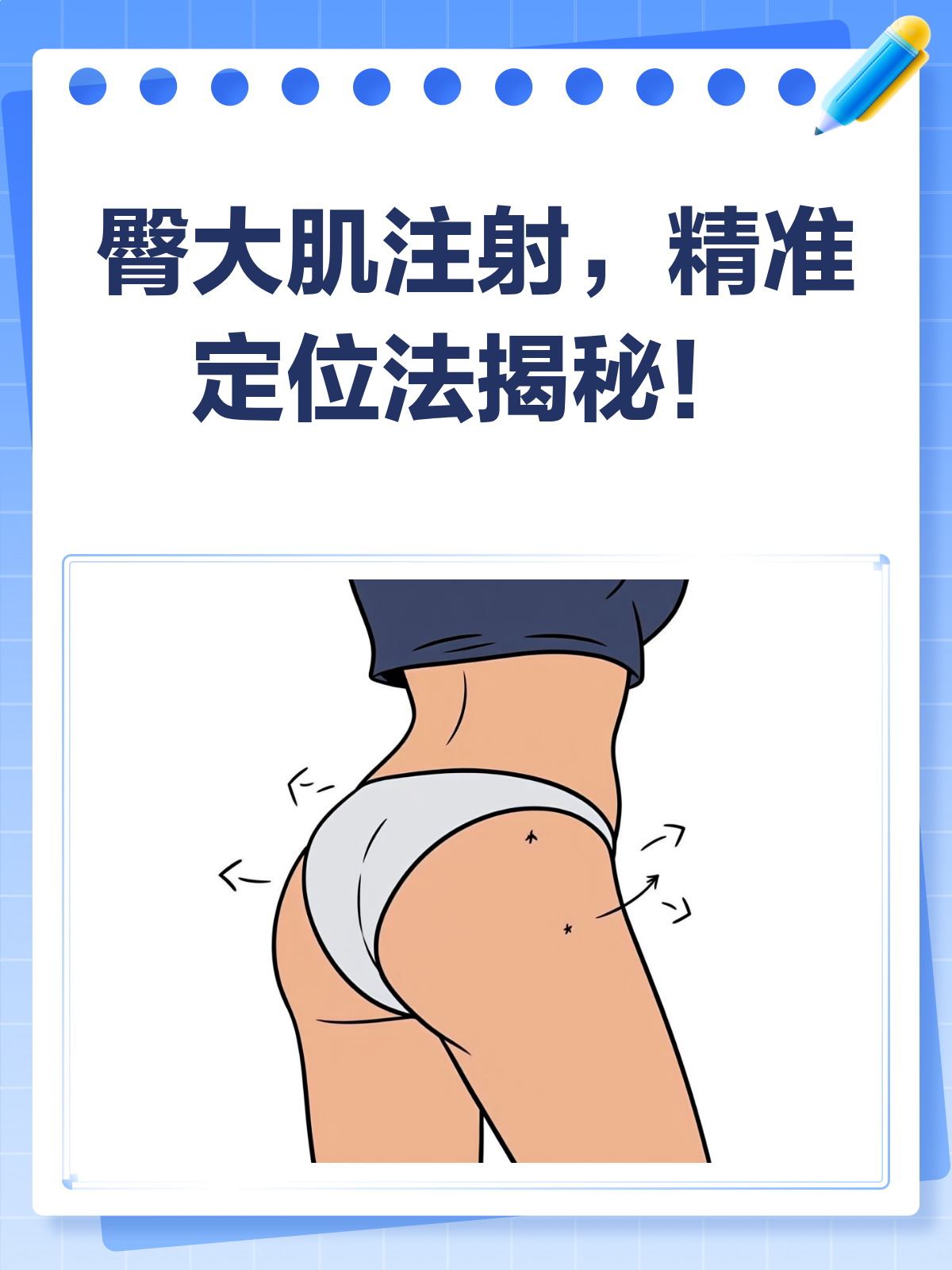 臀大肌注射,定位方法你学会了吗?