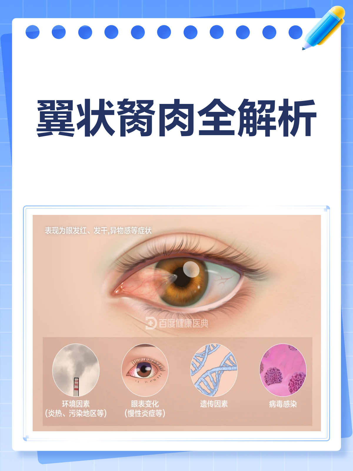 翼状胬肉来袭？了解它，才能战胜它！