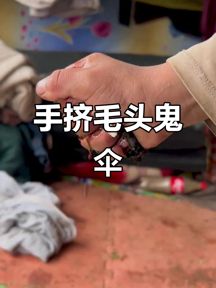 夏季牧场上的百鬼伞,变老前竟能炒肉吃!