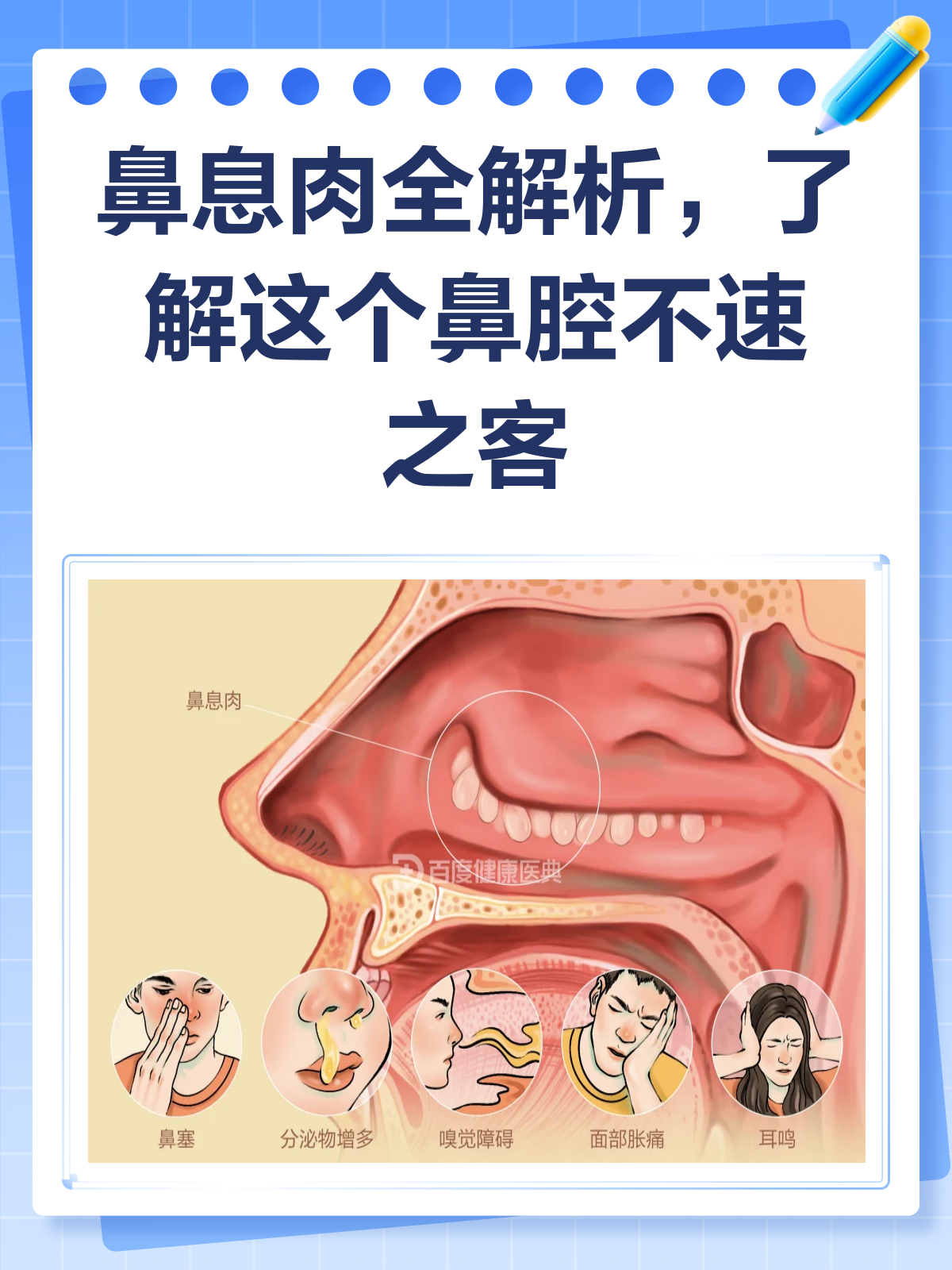 鼻息肉知多少?揭秘鼻腔里的“不速之客”!