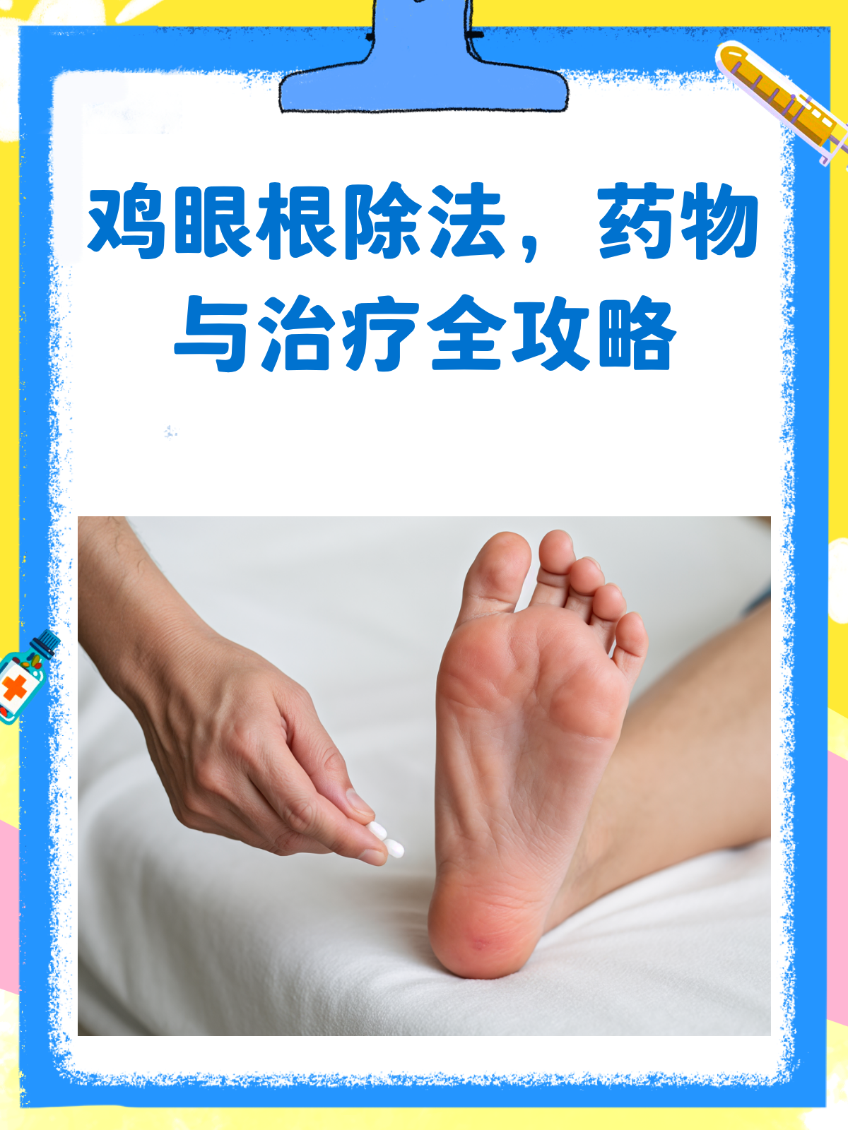鸡眼烦恼?来看这份根除攻略