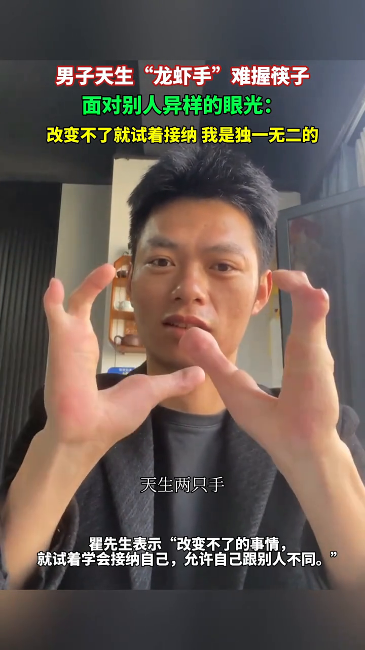 男子天生“龙虾手”难握筷子，面对别人异样眼光：改变不了就接纳