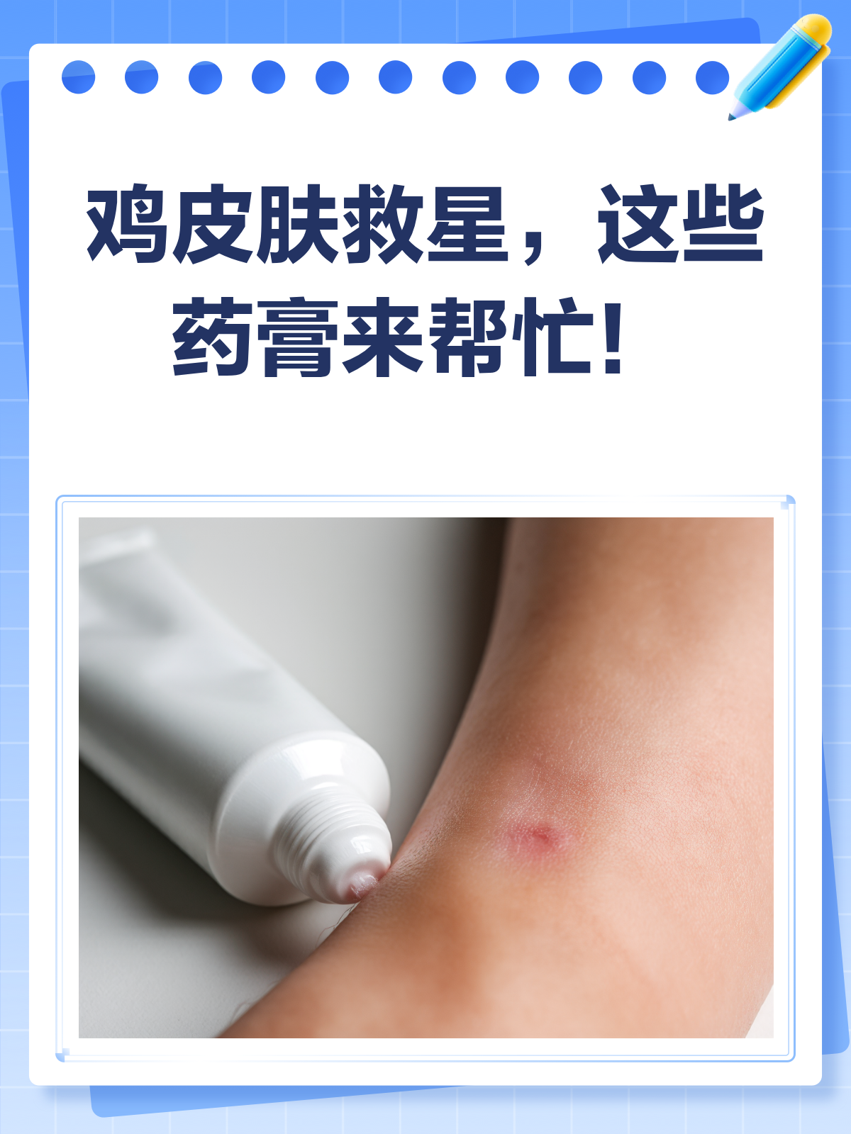 鸡皮肤烦恼多?这些药膏来帮忙