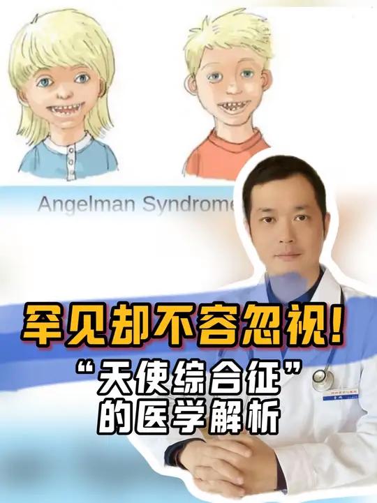 罕见却不容忽视,“天使综合征”的医学解析