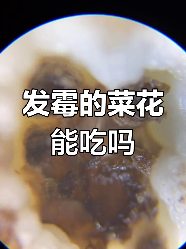 菜花上的黑点是什么?显微镜揭秘