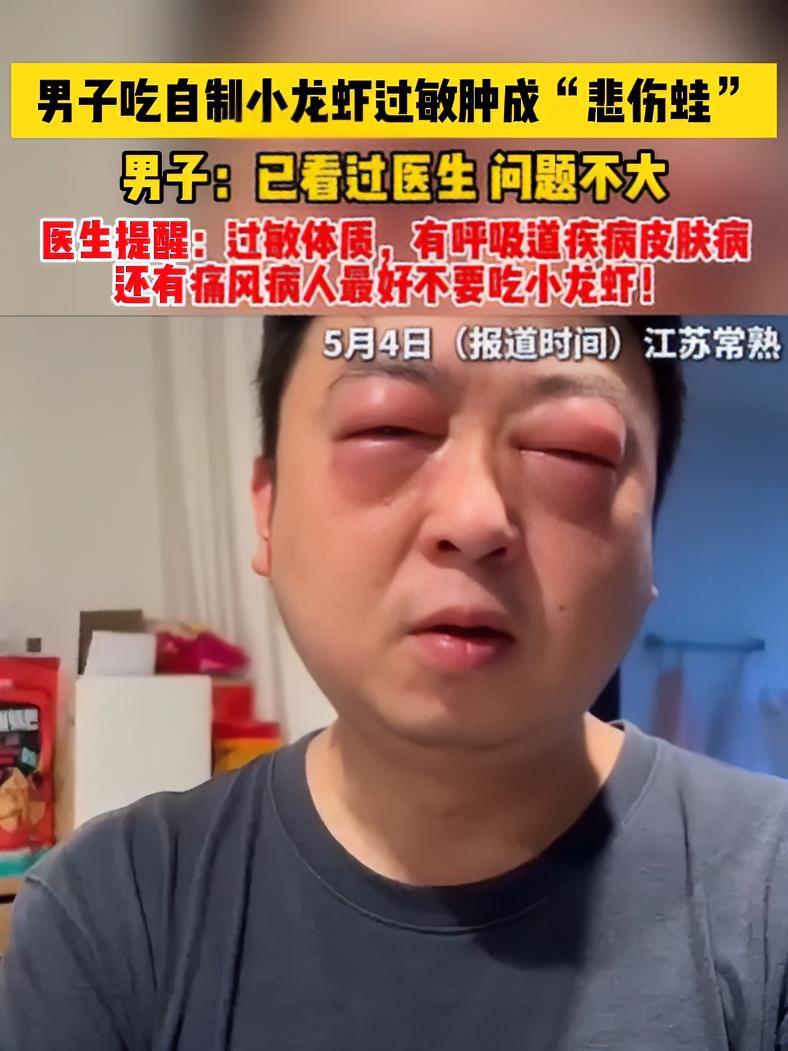 男子吃自制小龙虾过敏肿成“悲伤蛙”,男子:已看过医生 问题不大,医生提醒:过敏体质,有呼吸