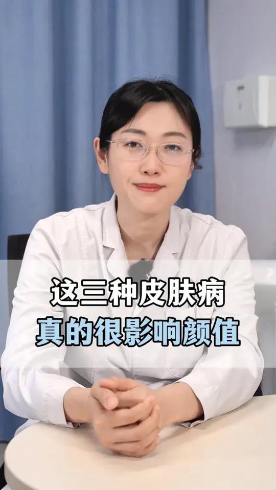 这三种皮肤病,真的很影响颜值!