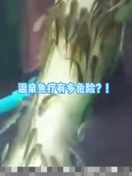 旅行时,警惕这个热门项目——温泉鱼疗!